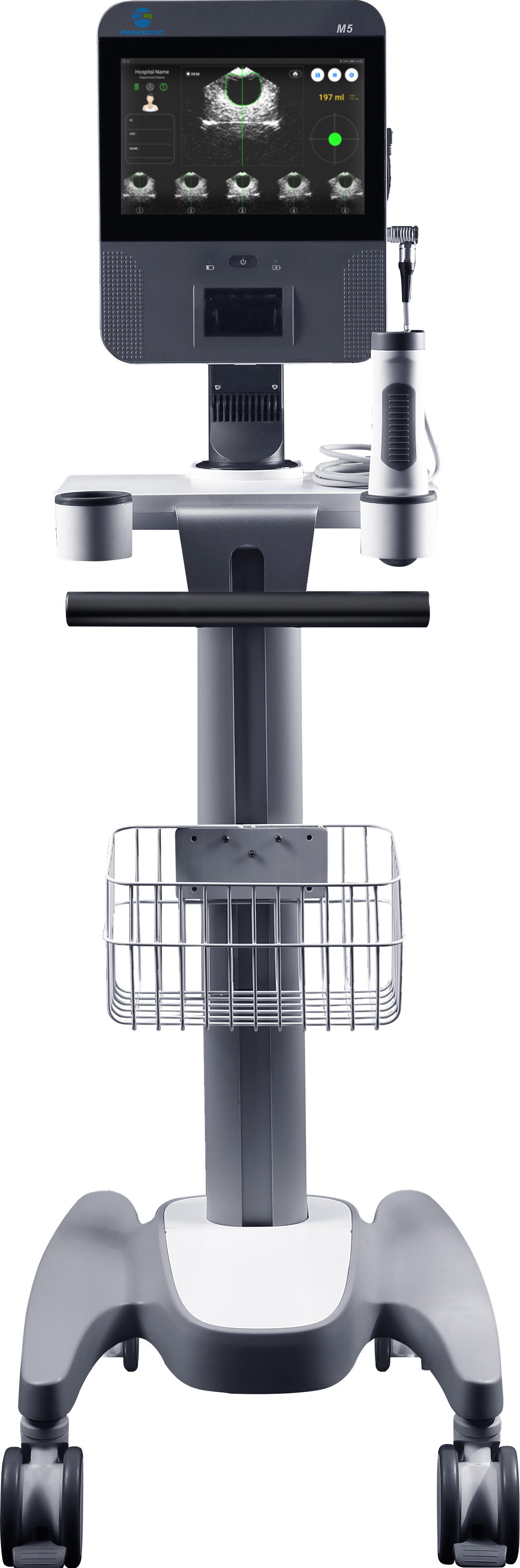 Bladder View M5 – Avancerad 3D-ultraljudsscanner för urinblåsan