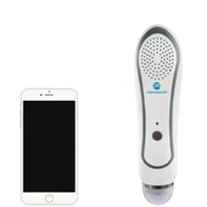 BladderView M3 – Handhållen Bladderskanner med 2D-ultraljud